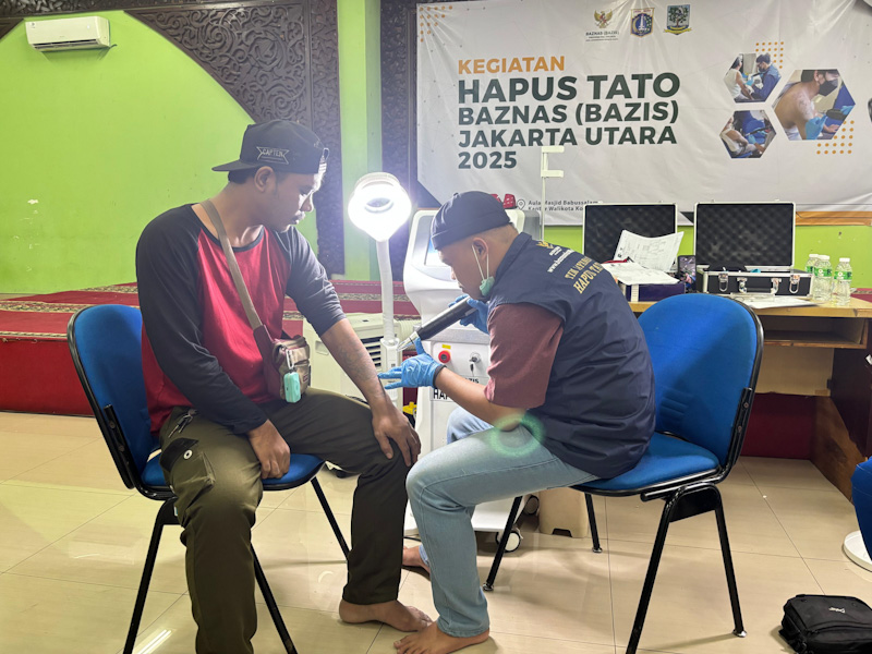 100 Orang Manfaatkan Layanan Hapus Tato Gratis Baznas (Bazis) di Jakut