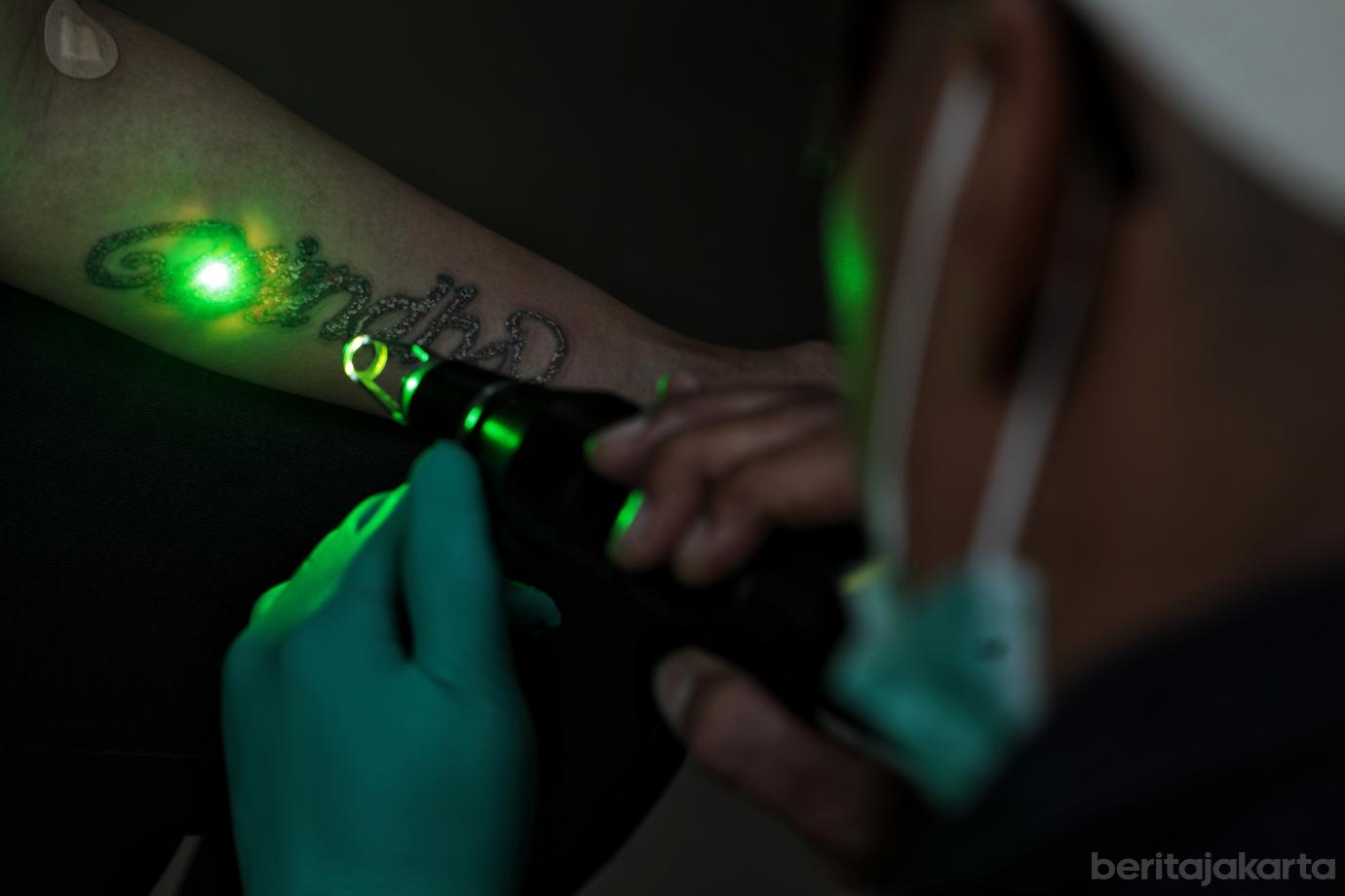 5.Hapus Tato Gratis di Masjid Sunda Kelapa Sasar 100 Warga